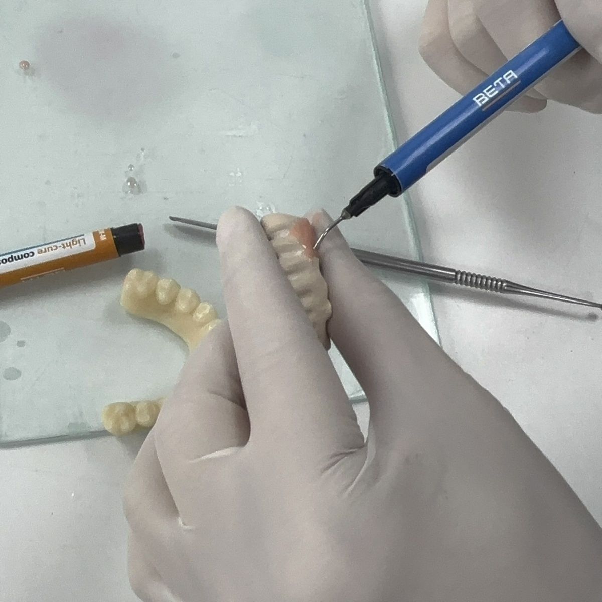 치과 재료 폴리머 포세린 브릿지 잇몸 레진 복원 크림형 - Uv Resin 리뷰 및 가격